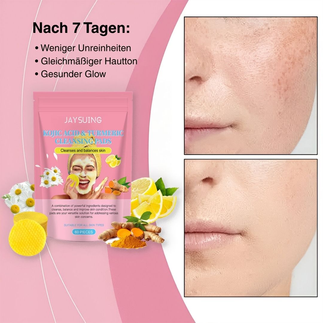 PureGlow Kurkuma Peeling Pads – Für strahlende & reine Haut