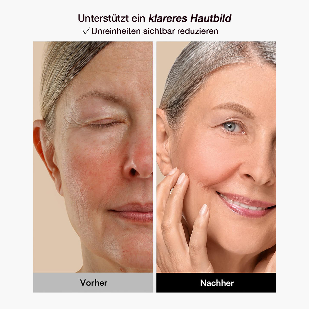 Purevia Glow 3D Elite LED Maske – Lichttherapie Gesichtsmaske für Akne & Anti-Aging