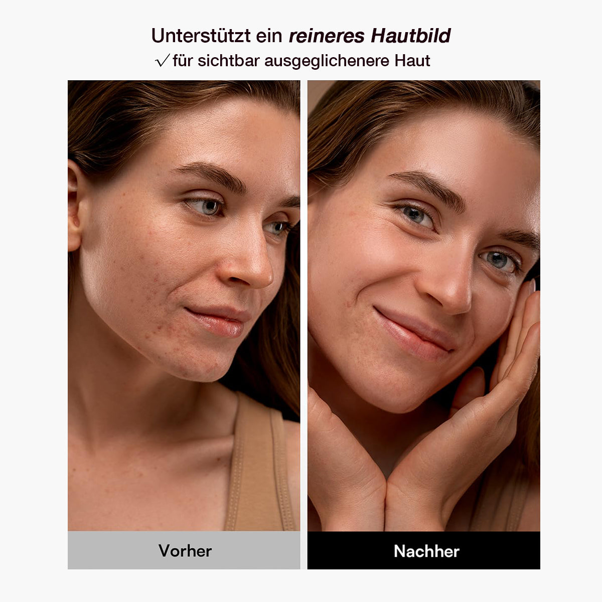 LED Maske Dripdeal – 8-Farben Lichttherapie Gesichtsmaske