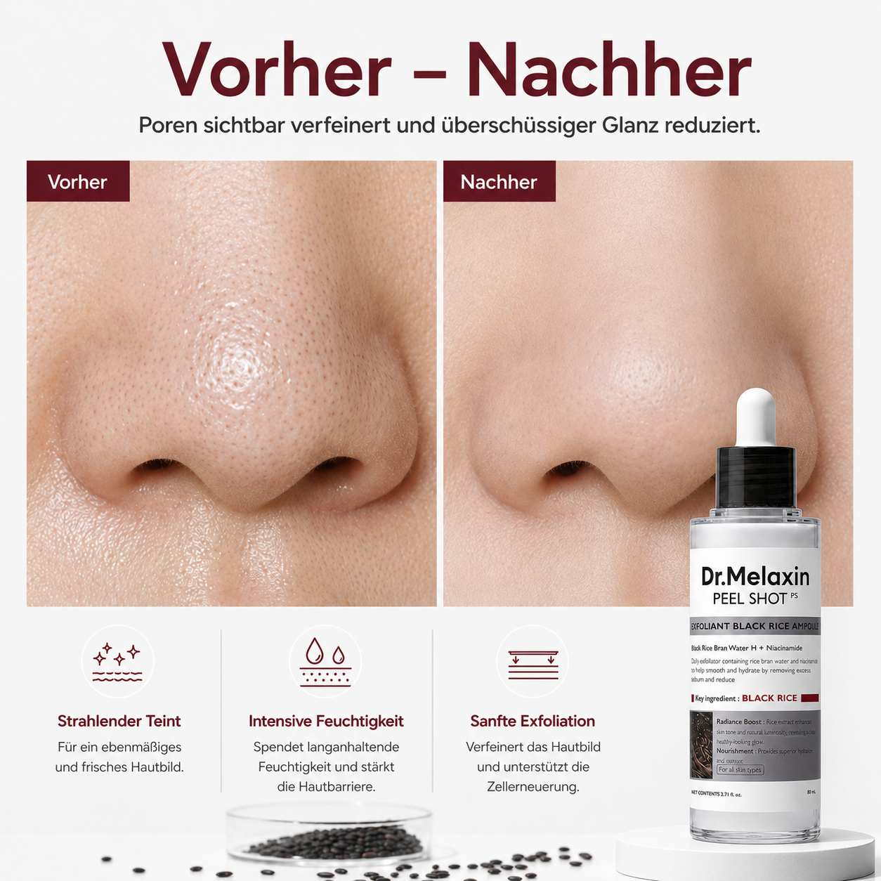 Peel Shot – Black Rice Porenpflege Serum | Koren Skincare