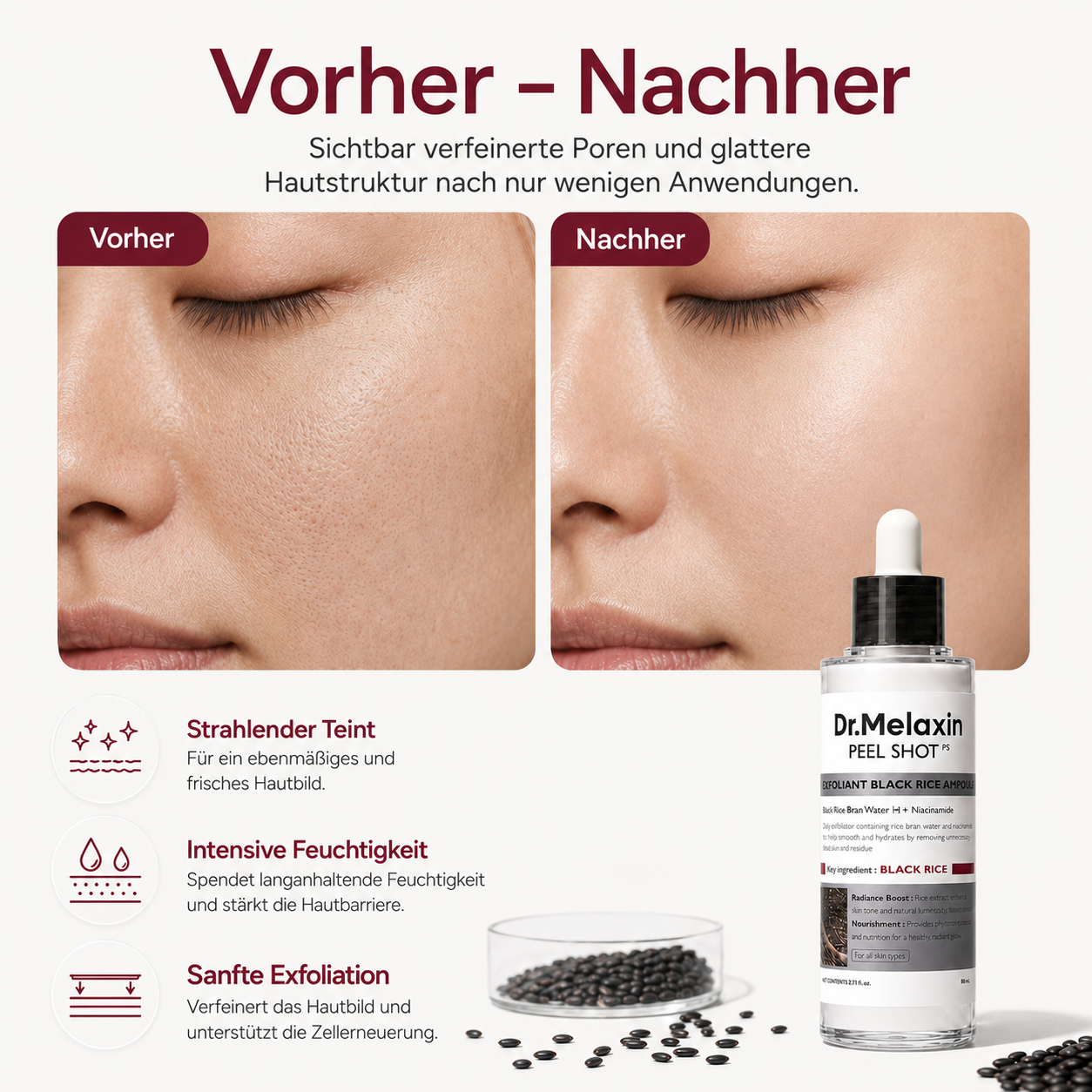 Peel Shot – Black Rice Porenpflege Serum | Koren Skincare