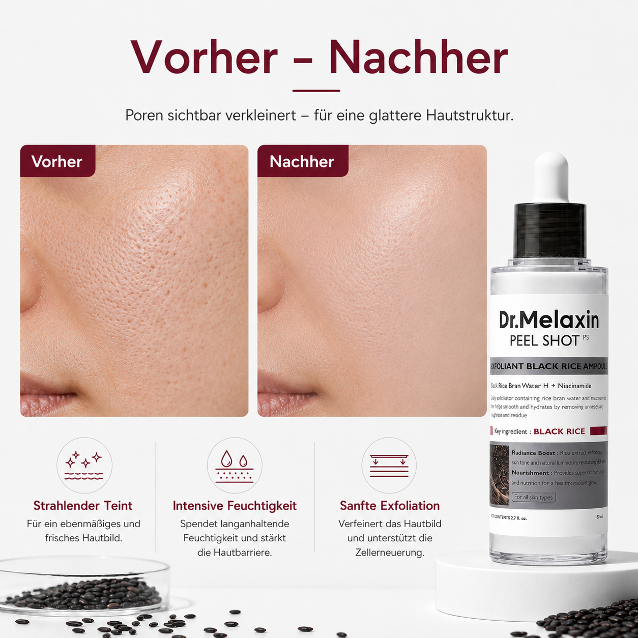 Peel Shot – Black Rice Porenpflege Serum | Koren Skincare